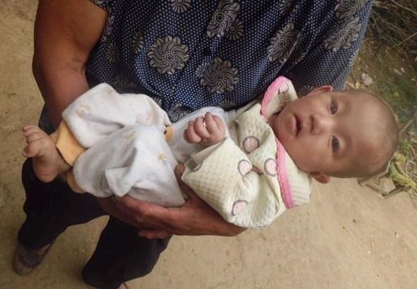 ��С���ܳ�������Ϊ���ಡ���������ӱ�����С�ܶࡣ