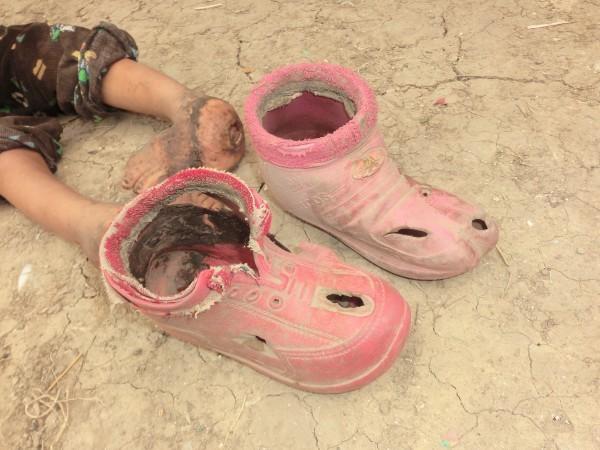 ������˫�ŵĻ�����״ ���ᷢ����ζ