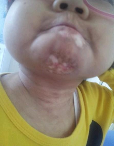 ��������Ƥ��ֻҪ��΢�ܵ��̼��ͻ����ݱ�Ϊ����һ�����˿ڣ��������ϣ��Һܶ�ʱ�򶼲���ֱ�Ӻ��ӣ�������Ŀȫ�ǵ����²��ۺ�ʱ�Ҷ������ֱð��