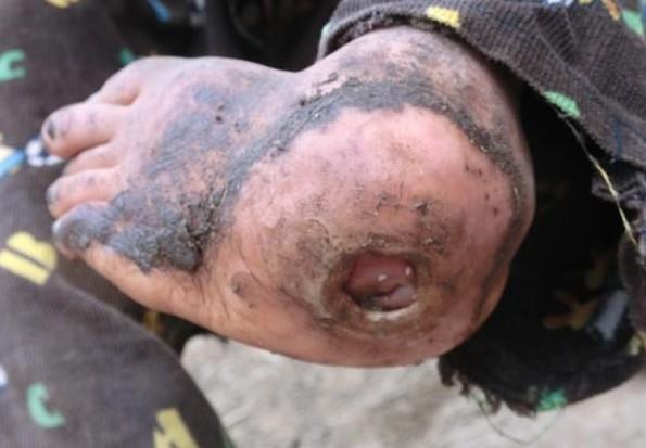 ������ĽŽӴ�����ĵط��Ѿ�ĥ�Ʒǳ����أ�������������ɼ�����ɢ���ܳ���ζ��