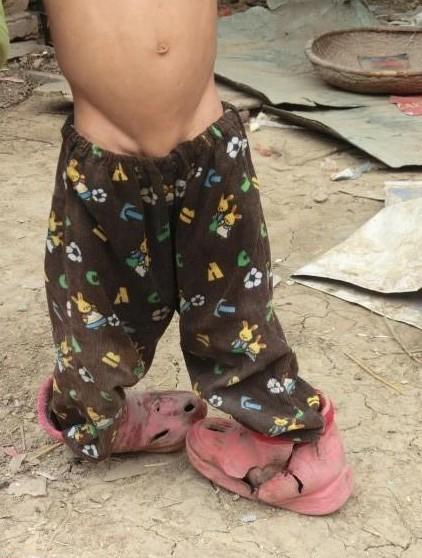 ����Ŀ���Ҳ�Ǳ��˸��ĺܲ����壬��Ҫ�������ӣ���ֻ�����ڷ���