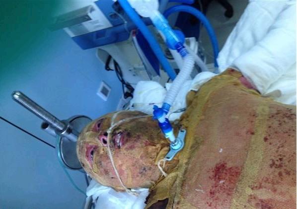 �ָ�һЩ�����Σ��ڴ���һֱ������ȥ