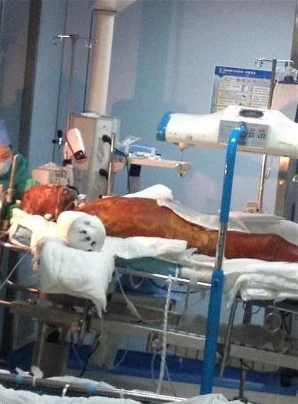 �໤֮�У��޷������������˶���ʹ��