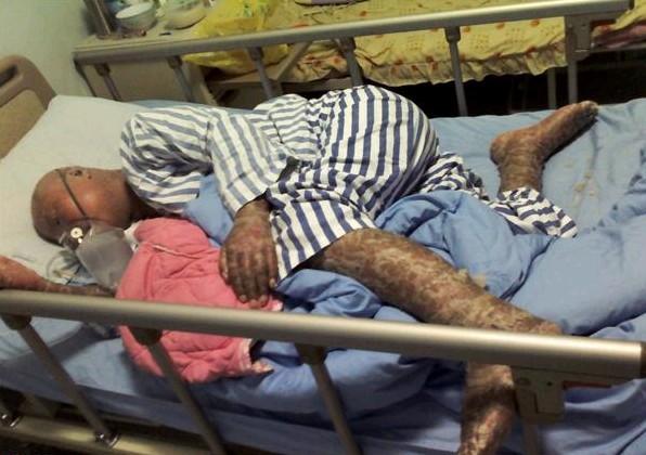 ��ʱȫ����Ƥ�����а����ˣ����ҵ�ʹ�������ô�÷�޷����ܣ�����������