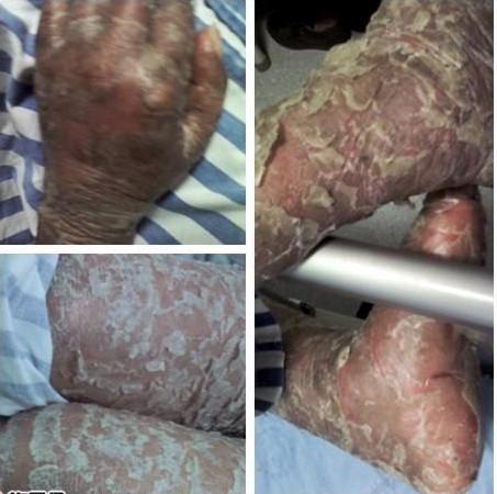 ȫ����Ƥ��ÿ������ز�ͣ�ص������ڵ��׵��ֽŶ����׵ġ�4��17�պ󣬵ھ��Ƴ̿�ʼ��תֱ������