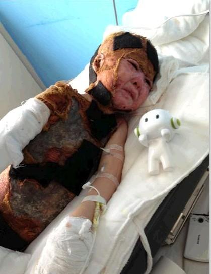 ���ź����ڿ�������ĸ˺���ѷε���ʹ