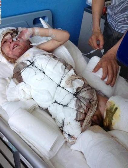 ���Ͻ��н�֫�����ˣ������Ҫ��֫�������Ѿ���ʼ�ڿ�����