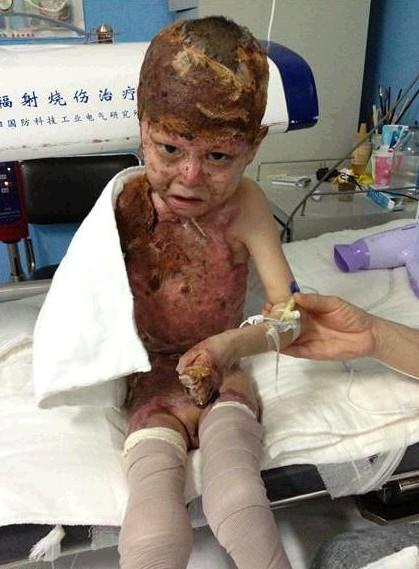 û�г���֮ǰ���ֻ��ǳ�������ģ��������ڸ߶����ˣ����Ӳ��ܳԶ������Ѿ�Ƥ������