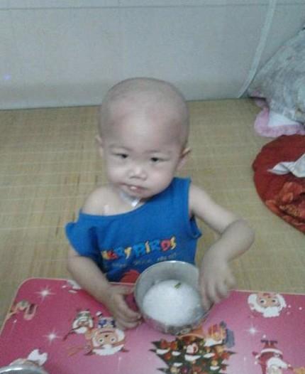 С�����Ѿ���ҽԺס��4�����ˣ�ÿ�춼�ǰְֻ��������������չˣ�����С�����ܹԣ�ÿ�δη���˵Ҫ�Լ���