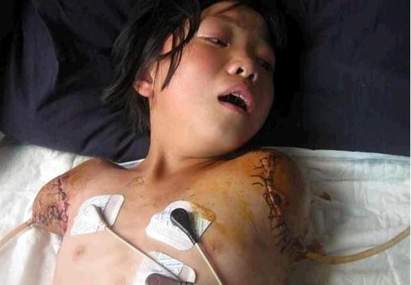 ʧȥ˫�۵�С��ʮ��ʹ�࣬�˿ڵ���ʹ�Ѿ��Ѻ�����ĥ�Ĳ������Σ�����Ҫ���������ʹ��