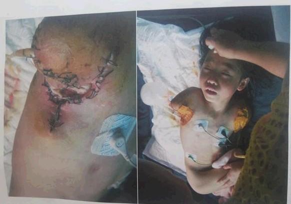 ���ڵ��ص�ҽ���������ޣ������˿ڿ�ʼ��ŧ���˿ڵ���ʹ��С�᲻ͣ�������������ڸ����Ӳ���