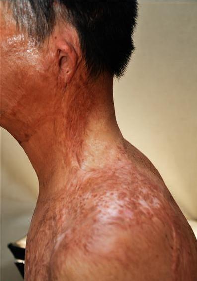 ���������ȫȱʧ����������������ģ���������������ޡ��̺������������������󾱲���������̧ͷת�����ƫ  ��粿��ؽڹ����ϱۻ���������չ�������Ͼ٣��������ޡ���2013�꣩