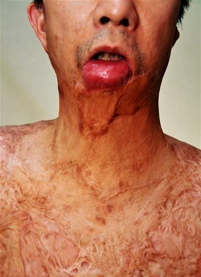 ��򢲿��������̺��ڡ���������������ɾ�����С������̧ͷ���´��ⷭ��ǰ�ز����2���׵����������������˫�ϱ���չ�������ޣ�����ֱ�����ѡ���2013�꣩