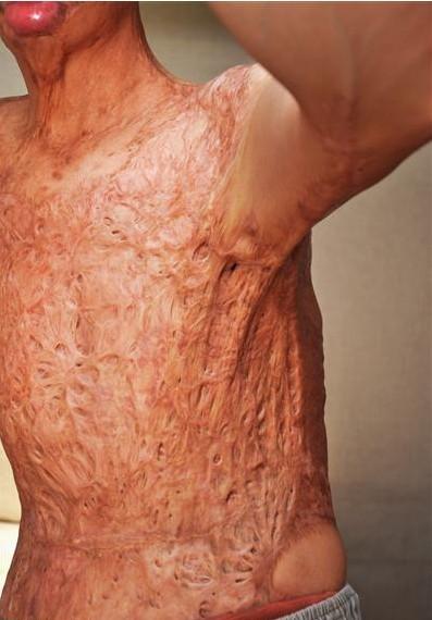 ��Ҹ�±��̺۰�����������Ⱦ��ŧ���ϱ۲�����չ���Ͼ����ѣ��������ޡ������������̺ۺ��3-4���ף������������ת�����ѡ���2013�꣩