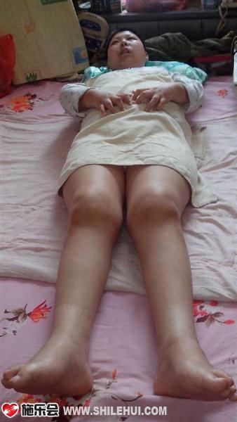 ���ǻ���20������ʪ�ؽ��ף�ȫ�����еĹؽڶ����ν�ֱ��ÿ����ʹ���̣�������ҽԺ���˴����ļ��أ�����ȫ������