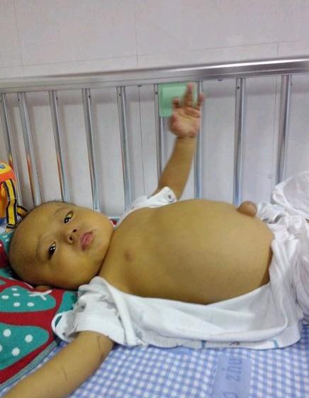 ��������ǰ��δ�Ƣ�󣬸�ˮ��������Ķ��ӣ�Ѫ�������ɼ���������Ҳ�򸹲���ѹ����͹���ڿ޵�ʱ����Ӹ��󣬶����۸�͹����������������˽������£���  