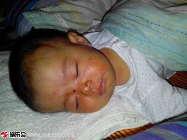  �����ӵģ���֭����ߣ�Ƥ���������ҿ����ĺ��ӣ�