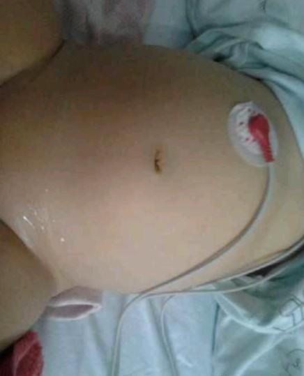 ��������һ���ˮ���������ų�̫�٣������Ķ���Ҳ��ˮ����ϸ���٣�ѪС��ܵ�