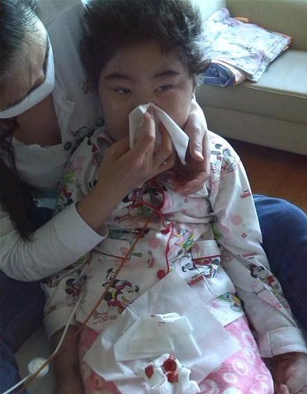 ��ֲ�Ժ�Ѫ���ǲ��ã�ѪС��̫�ͱ����ֳ�Ѫ��