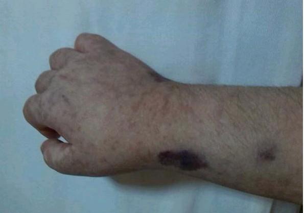 ������ǧ���ٿ׵��ֱۺ����ƺ��ֱ۵ĸ��ף�һ�������ʹ��Ȼ����  