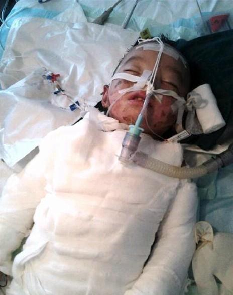 ������Ө�ĸ�ĸ��ICU̽����ʱ�����ֻ��ĵġ�С��Ө���Ϲ��ź���ɴ����