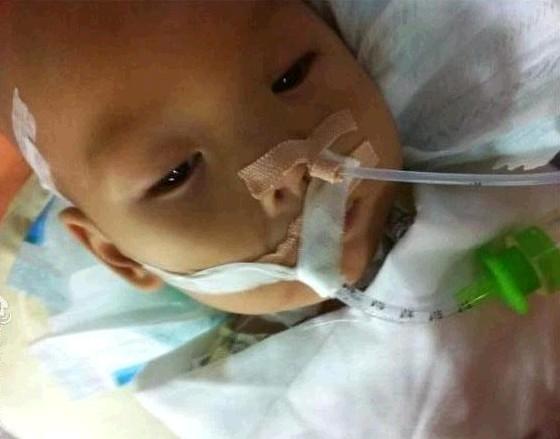 ICU��С���󣬺��̶�Ҫ��������ι���������Ҳ���Ǻܺ�