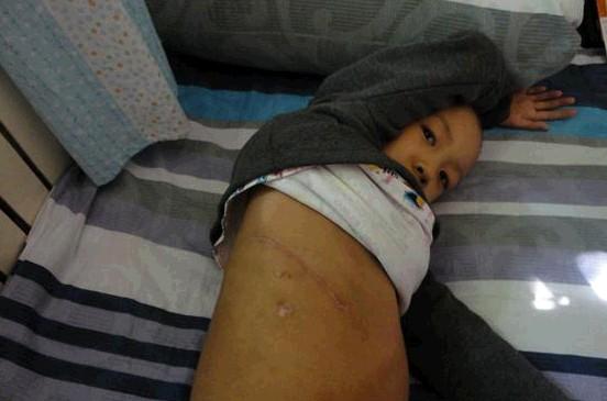 ���ǽ������������η������������µİ̺ۣ�ÿ�ο����Ķ�������һ����ʹ��