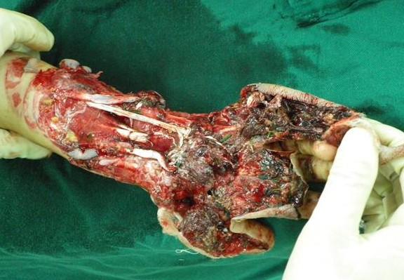 ���ǳ��µ���Ѫ��ģ�����֣�����ȫ�ǲ�м������޴������ˣ��粻�Ǵ��ҽ����տ��ҽ�¸�������ˡ�