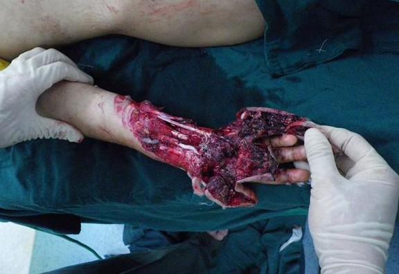 ����Ѫ��ģ�����֣����ǲҲ��̶á�