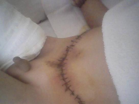 ��������Ƥ���Ķ�Ƥ���Ѿ���Щ���á�