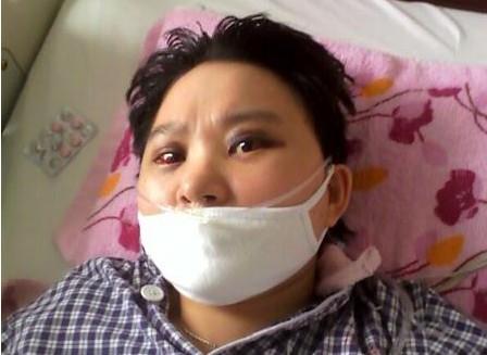 ���ƺ��������۾���Ѫ��ȫ�����ף�����ǳ�