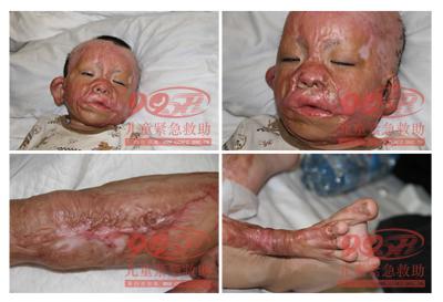 ������Ƭ