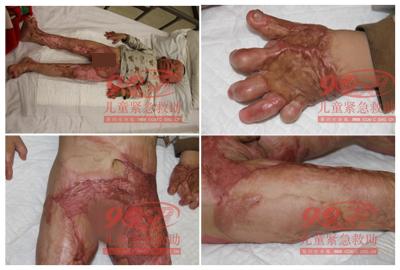 ������Ƭ1