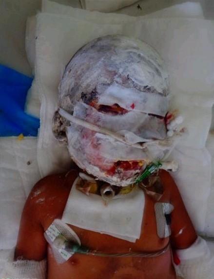 С��ƽͷ������֫�����ص����ˣ����ǿ��Կ������ӵ����壬�����Ѿ�����������ԭ������Ŀ��  