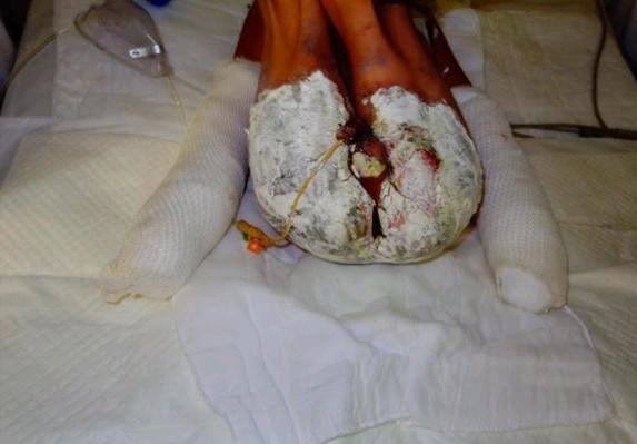 С��ƽ��ƨ��ȫ�����ˣ��Ѿ���������