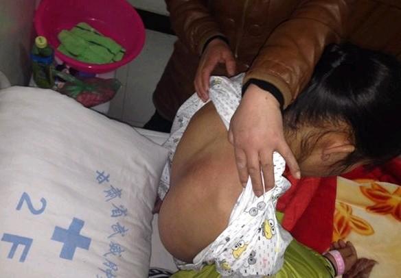 ����ϼ�ĺ󼹱�����Ϊ�������䣬�����Ѿ����ر���  