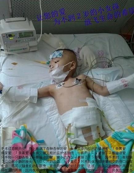 ����֮���С���ã����ϲ����˸��ָ����Ĺܣ�θ�ܡ���ܡ������ܡ��໤�����ߵȣ�һ��15����  