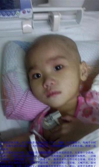 �������С���ã����ڽ�ˮ��ʳ��״̬����һ���£��촽һ��һ��Ŀ��ѡ�ÿ��СʱͿһ��ά����E�͸���һ���ö�û�У���������Ⱦ������һֱ������  