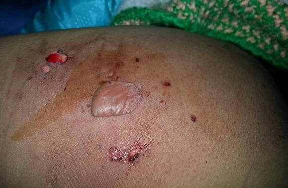 ��ѩޱ�ڷ��ƹ����б���Ⱦ��