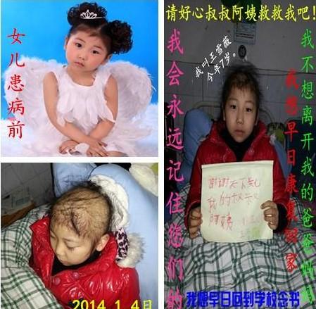 ����Сѩޱ����ǰ�����������Ƭ��