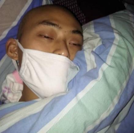 ������Ļ��ƺ������˱��ͷ���ۻ���5��ǰ��β���������Ѿ��ָ����˿ڣ�������ҩ���룬������Ⱦ���۵Ĳ�Ը�����۾���