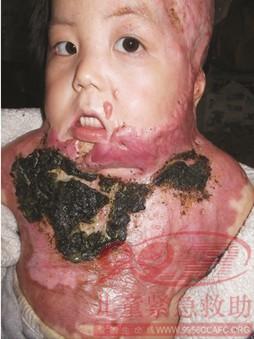 ������Ƭ