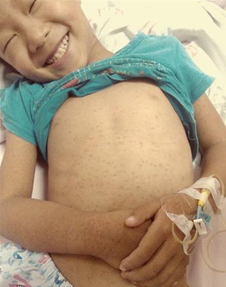 ��һ�Ƴ̵Ļ��Ƹ���������İ�Ѫ֢�����  Ц�Ļ�����ô���ģ�Ц�԰�Ѫ������ǿ�ĺ��ӣ�������ô���ķ�����