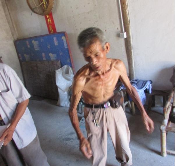 ��������ɷ���ݣ�ֻʣƤ����ͷ�����Ѿ��첻ֱ��