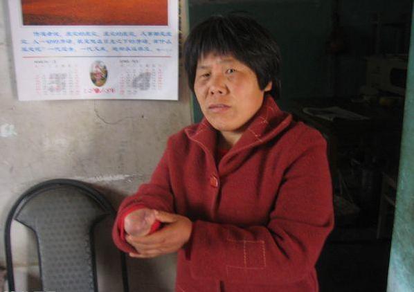 ��ѩ÷�������вм�������û���Ͷ�����