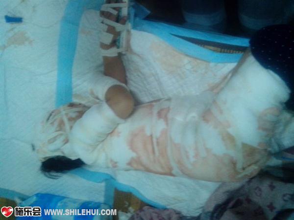 �ź��������Ѿ�û��һ��õ�Ƥ��