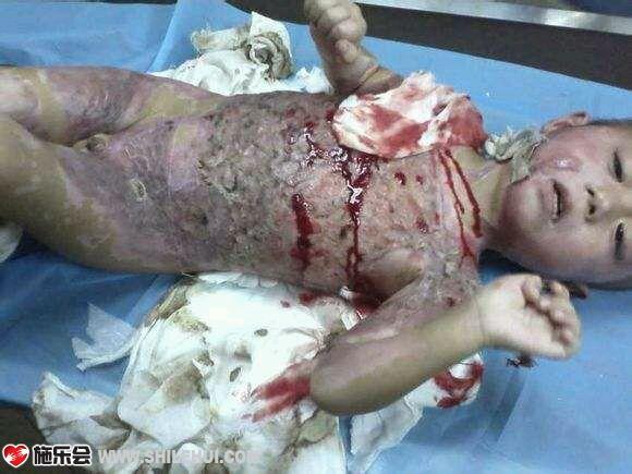 �ɳɲ���һ�����ͽ�����ȫ��40%��Ƥ�������ˡ�