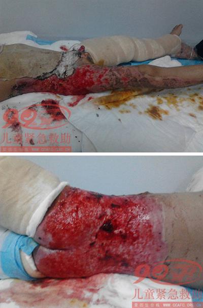 ���ӻ�����Ƭ1