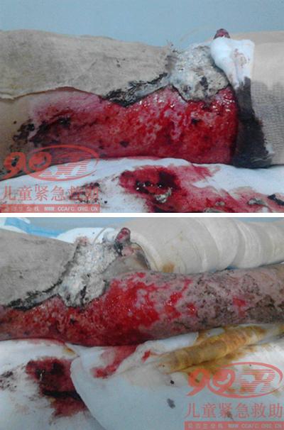 ���ӻ�����Ƭ2