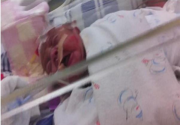 �������ܲ�ʹ����ĥ��